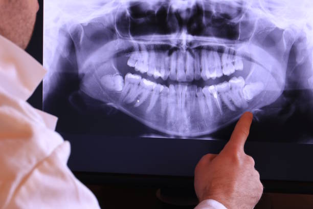 Best Emergency Dental Care for Sports Injuries in St Paul, NE